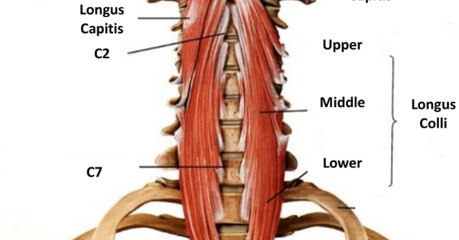 Overlooked Causes of Neck Pain image