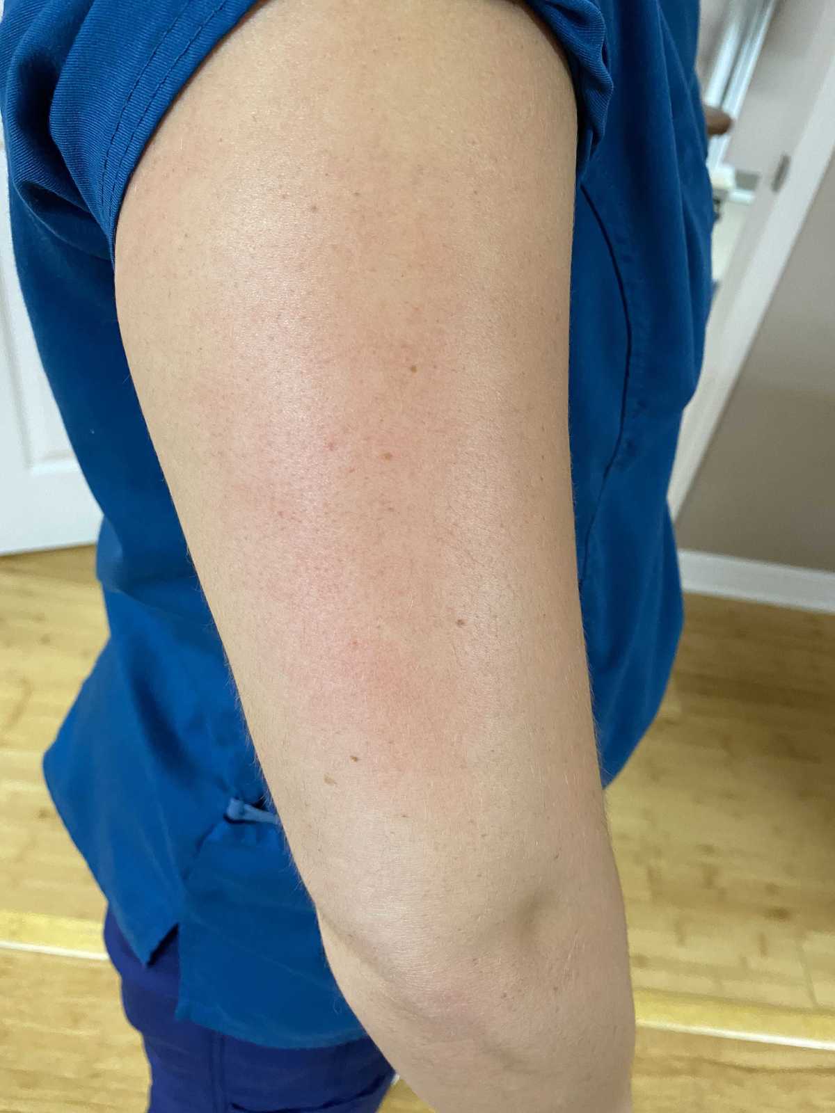 Tuesday's Tip "Scraping" Chiropractic Integrative Chiropractic